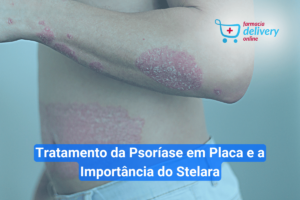 Tratamento da Psoríase em Placa e a Importância do Stelara